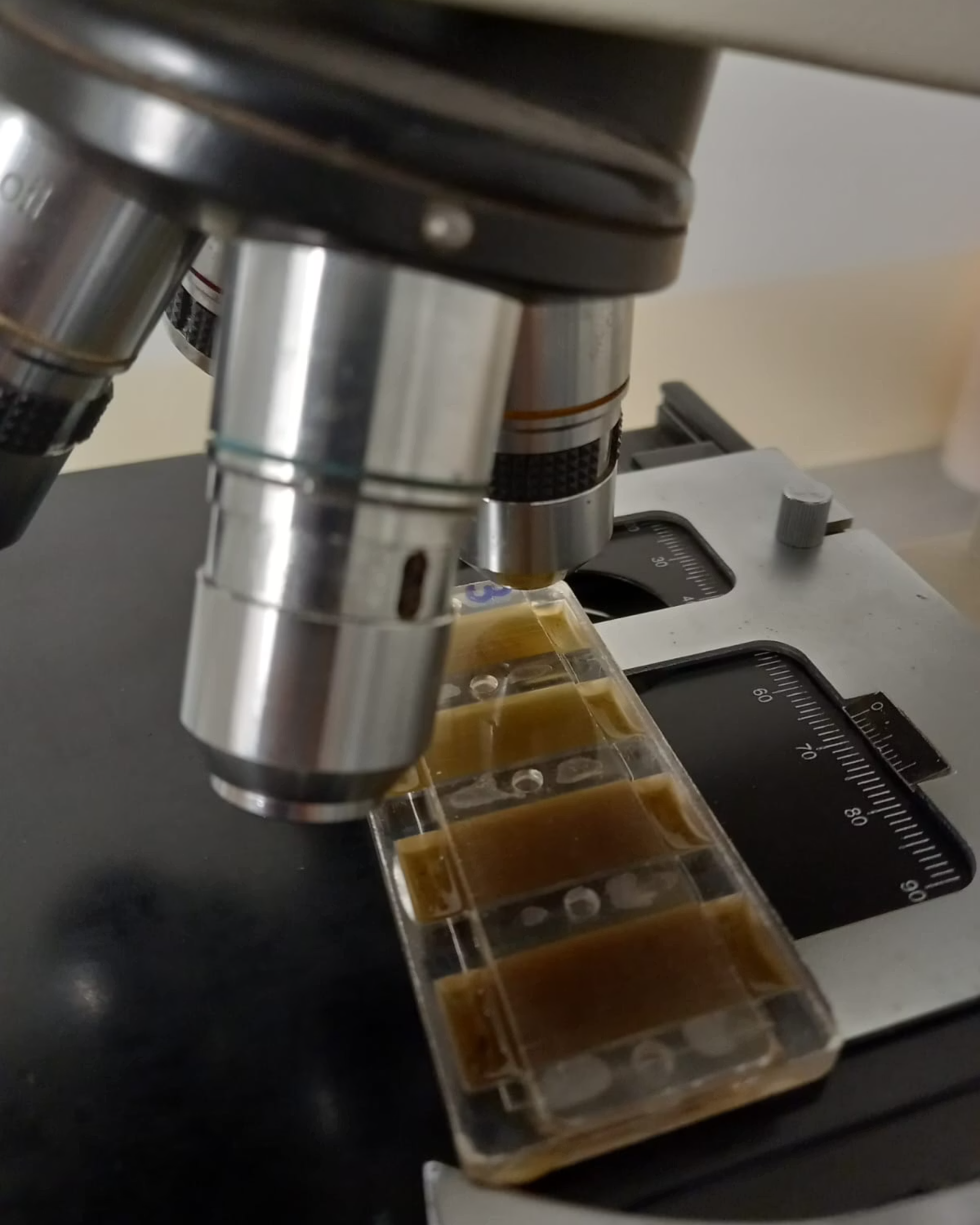 Observación al microscopio