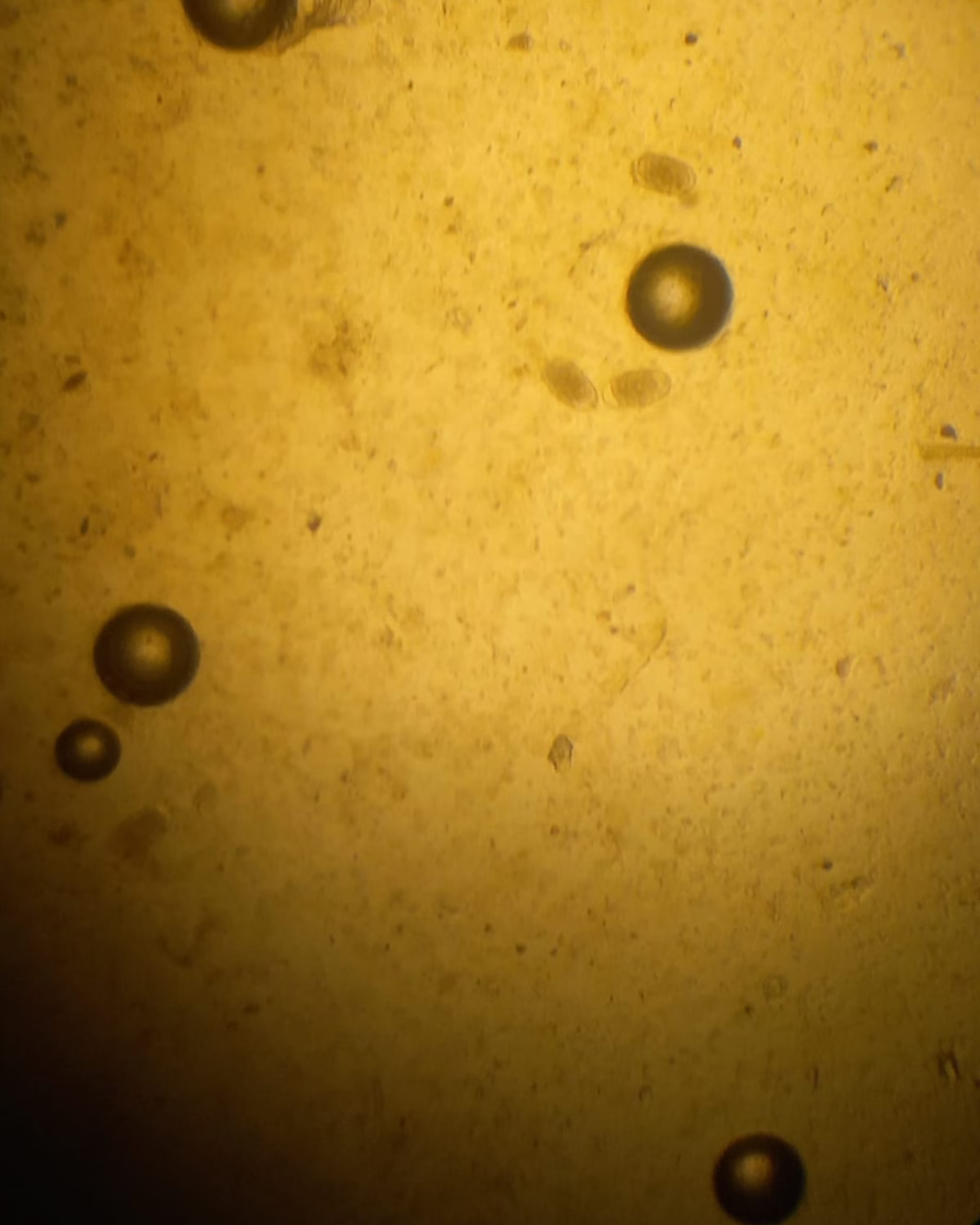 Huevos de parásitos observados al microscopio