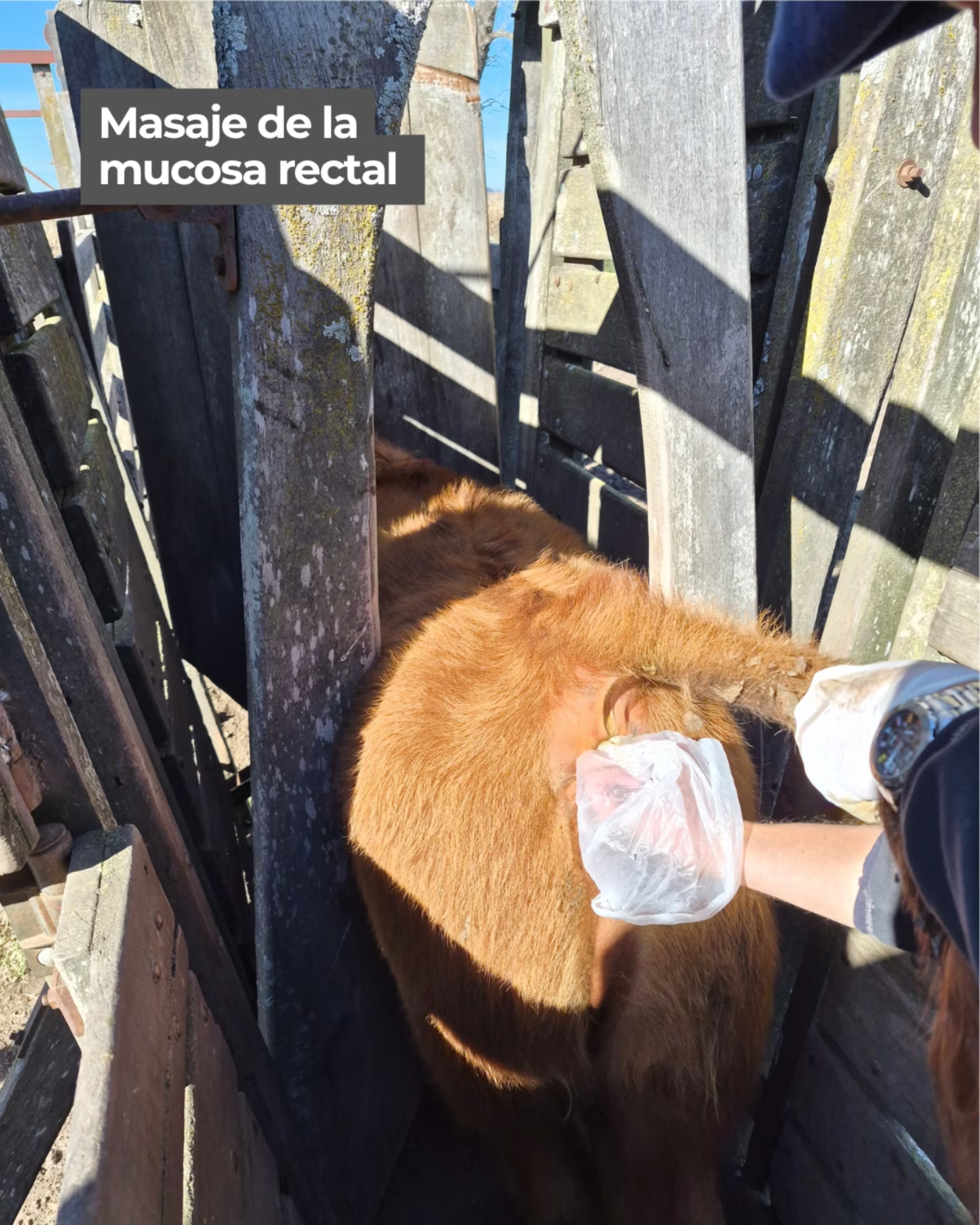 Masaje de la mucosa rectal para estimular la defecación